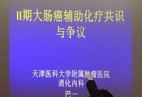 [CSMO2014]巴一教授：Ⅱ期大肠癌辅助化疗共识与争议